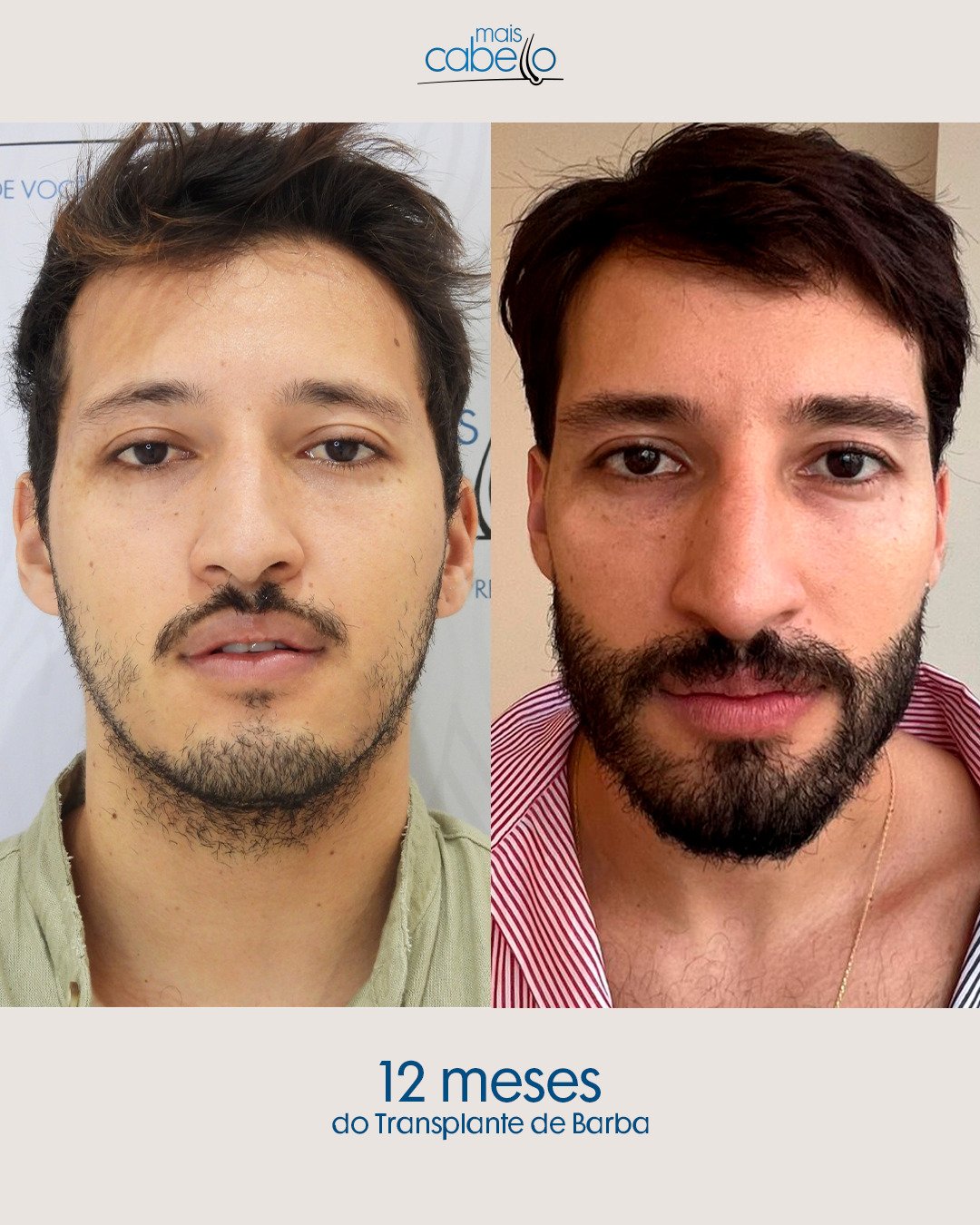 Antes e depois 6