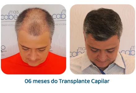Antes e depois 8