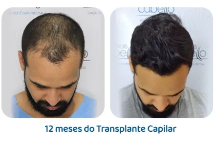 Antes e depois 9